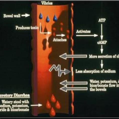 Pathogenesis of V. cholerae in the bowels; Source: [48] | Download Scientific Diagram