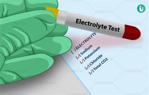 Electrolytes Test: Procedure, Purpose, Results, Normal range, Cost ...