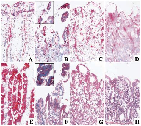 Zonula occludens 1 (A–D) and occludin (E–H) expression during ...