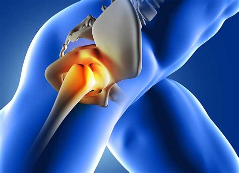 Hip, Buttock and Thigh Pain | Dr Usamah Jannoun