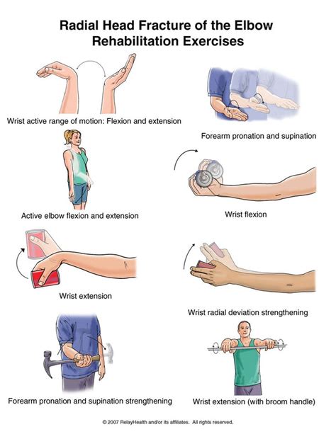 Radial head fracture of he elbow rehabilitation exercises | Physical therapy exercises, Nerve ...