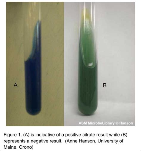 [Solved] Citrate Test Purpose: The citrate test screens a bacterial isolate... | Course Hero