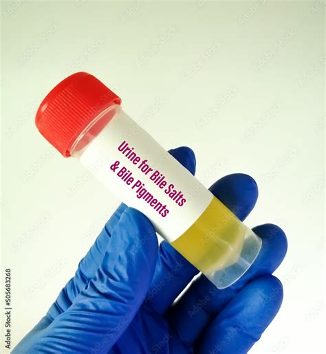 Urine sample for Bile salts and Bile pigments test. Stock Photo | Adobe ...