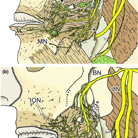 (PDF) The course and distribution of the buccal nerve: Clinical ...