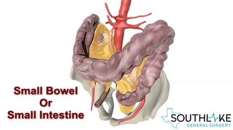 Small Bowel Resection- Purpose and Procedure - Southlake General Surgery