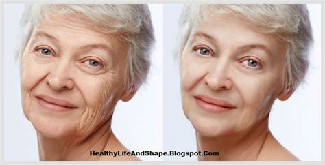 Remove Wrinkle On Face { Best Anti-Aging Secrets } - Healthy Life and Shape