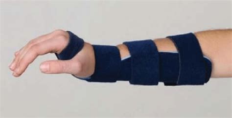 The Removable Wrist Splint (RWS) Used in the Current Study | Download Scientific Diagram