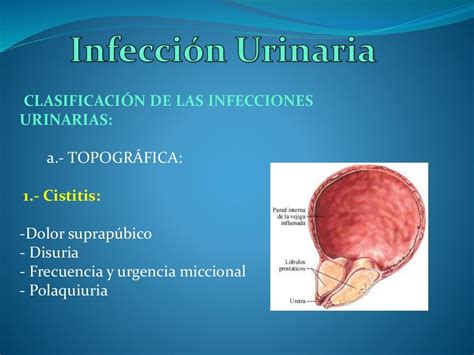 Infeccion urinaria pediatría