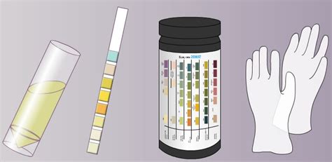 Urine Toxicology