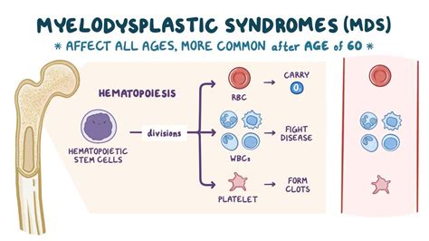 Myelodysplastic Syndrome - Symptoms, Causes, Types, Top 4 Ultimate Risk Factors