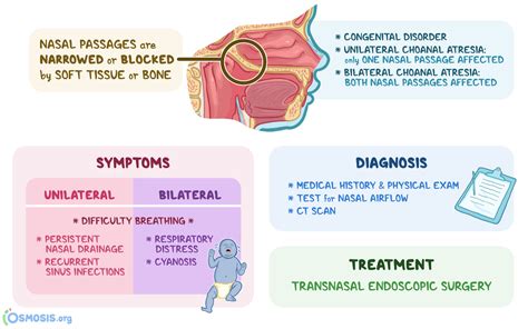 Choanal Atresia: What Is It, Causes | Osmosis