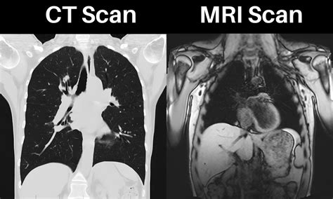 CT Scans VS MRI Scans: What are the Differences Between Them