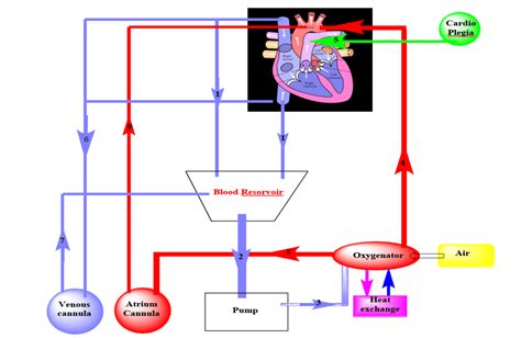 With neat sketch Explain Heart lung machine