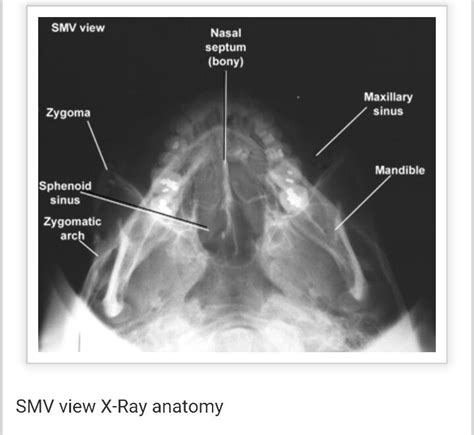 SMV view | Radiology, Medical knowledge, Medical anatomy