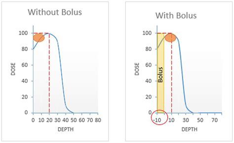 Thermoplastic Bolus for Targeted Radiation Therapy