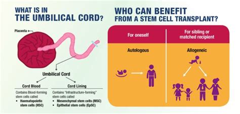 SG Budget Babe: Is Cord Blood Banking Necessary?