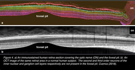 The Architecture of the Human Fovea – Webvision