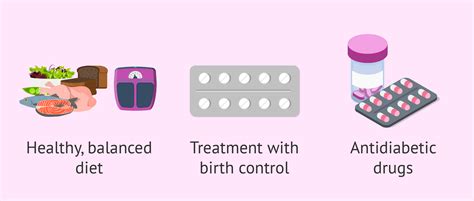 Treatment options for PCOS