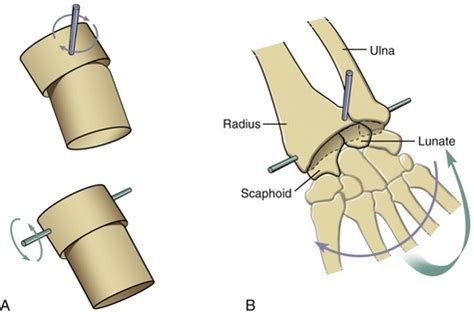 Basic Structure and Function of Human Joints | Clinical Gate