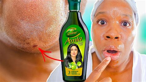 I Used AMLA OIL On My Skin Everyday FOR 12 DAYS - YouTube