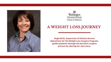 A Weight Loss Journey: Angie’s Story | Department of Surgery ...