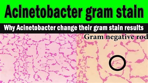 Gram Stain Results Interpretation - Solved: PART I: GRAM STAIN RESULTS ...