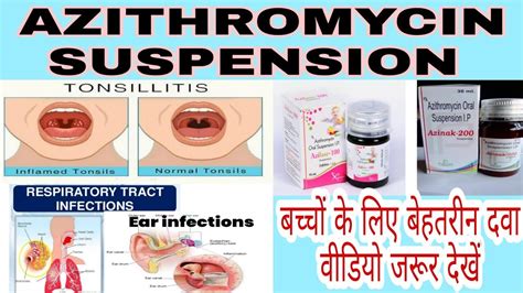 Azithromycin suspension / Azithromycin syrup uses, side effects - YouTube