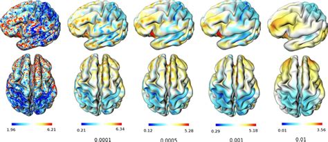 Cortical thickness measures projected onto an average surface for ...