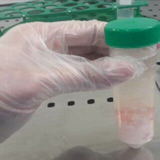 Isolation and extraction steps of MSCs: (a) the Wharton’s jelly was ...