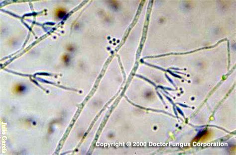 pae1_l - Doctor Fungus