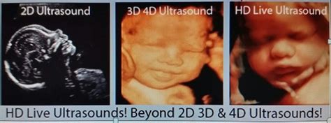 3d ultrasound places near me - Marlys Spain