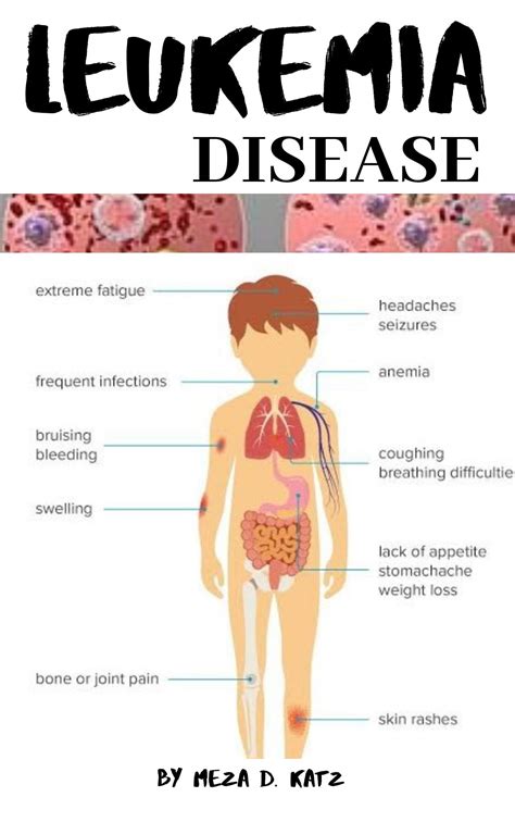 Leukemia Children Symptoms