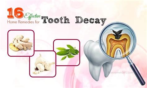 16 Effective Home Remedies For Tooth Decay Odor And Pain