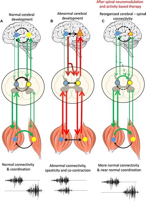 Frontiers | Engaging Spinal Networks to Mitigate Supraspinal Dysfunction After CP