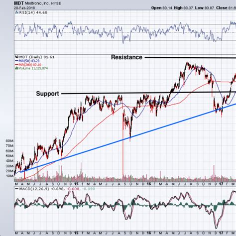 There Are Better Options Than Medtronic PLC Stock