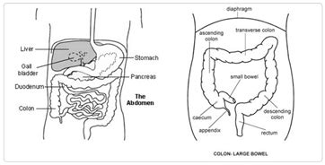 Sigmoid Colectomy Surgery,Cost Laparoscopic Sigmoid Colectomy India