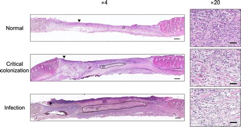 Histology of granulation tissue. N: normal group, CC: critical... | Download Scientific Diagram