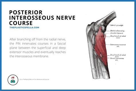 Posterior Interosseous Nerve Syndrome/Palsy - Illustrations, Videos