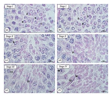 Steps of spermatid development during spermiogenesis of the testis of ...