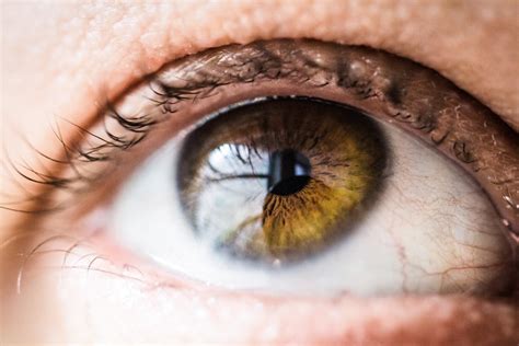 Restoring Vision: Long-Term Recovery After Scleral Buckling – Eye Surgery Guide