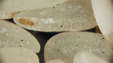 Meet the Dust Mites, Tiny Roommates That Feast on Your Skin | KQED