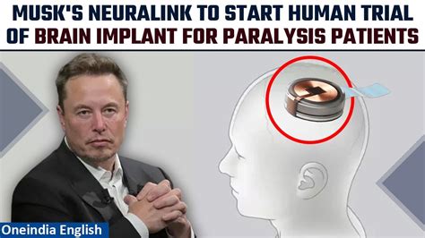 Elon Musk's Neuralink to start human trial, to test brain chip in paralysis patients | Oneindia ...