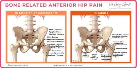 Differential Diagnosis of Anterior Hip Pain - Bone | Dr Alison Grimaldi