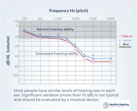 Asymmetrical hearing loss: When one ear has more hearing loss than the ...