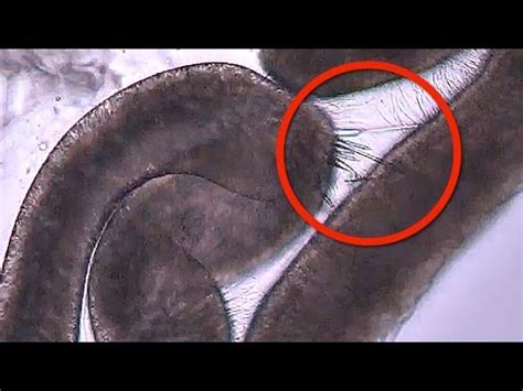 Jellyfish Stinging in MICROSCOPIC SLOW MOTION - Smarter Every Day 120 - YouTube