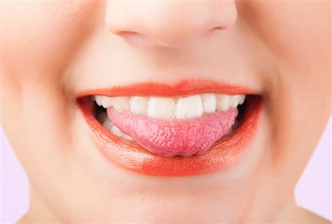 Home Remedies to Get Rid of Tongue Blisters | Top 10 Home Remedies