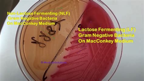 Lactose Fermenter and Non-lactose fermenter bacteria Demonstration - YouTube