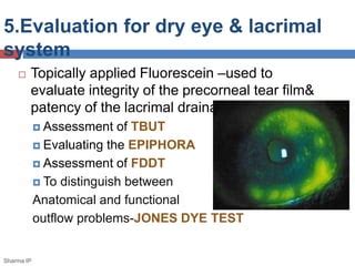 Fluorescein Stain | PPT