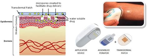 Pin on Transdermal Patches