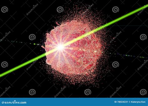 Laser Therapy of Cancer Concept Stock Illustration - Illustration of ...